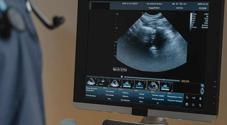 ultrasound imaging